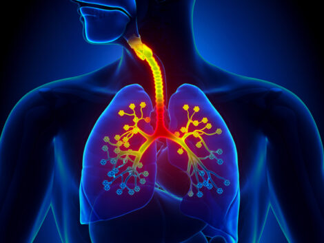 bronhijalna astma