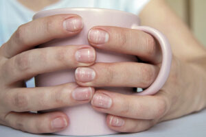 Narodni lekovi za zdravlje noktiju