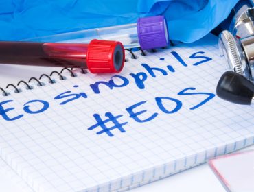 povišeni eozinofili u krvi