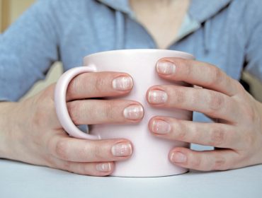 Bele tačke na noktima: Saznajte šta ih uzrokuje i kada ukazuju na određene bolesti